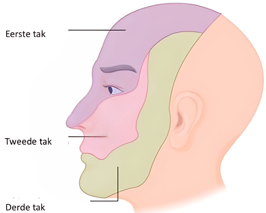 Afbeelding: Medische illustratie van het aangezicht – een gezicht in profiel waarop de drie takken van de trigeminuszenuw (nervus trigeminus) te zien zijn