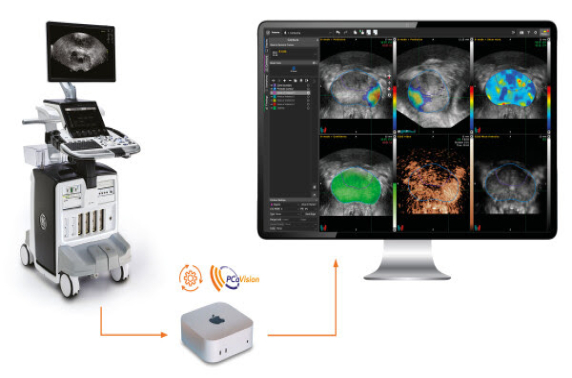 PCaVision: Investeringsronde voor versnelling van AI-gedreven prostaatkankerdiagnostiek