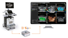 PCaVision: Investeringsronde voor versnelling van AI-gedreven prostaatkankerdiagnostiek